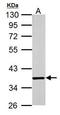 COP9 Signalosome Subunit 5 antibody, GTX70203, GeneTex, Western Blot image 