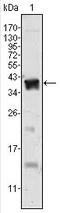 Androgen Receptor antibody, AM06392SU-N, Origene, Western Blot image 