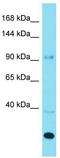 ArfGAP With GTPase Domain, Ankyrin Repeat And PH Domain 3 antibody, TA333627, Origene, Western Blot image 