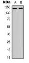 WNK1 antibody, LS-C358398, Lifespan Biosciences, Western Blot image 