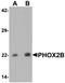 Paired Like Homeobox 2B antibody, orb75741, Biorbyt, Western Blot image 