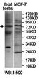 Phosphatase and actin regulator 4 antibody, orb78040, Biorbyt, Western Blot image 