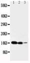 Interleukin 2 antibody, PA1466, Boster Biological Technology, Western Blot image 