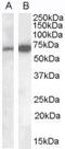 Cell Adhesion Molecule 4 antibody, PA5-18804, Invitrogen Antibodies, Western Blot image 