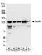 Mitotic checkpoint serine/threonine-protein kinase BUB1 beta antibody, NB100-579, Novus Biologicals, Western Blot image 