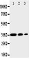 CD163 antibody, PA1874-1, Boster Biological Technology, Western Blot image 