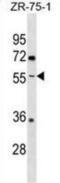 Ectonucleoside Triphosphate Diphosphohydrolase 5 (Inactive) antibody, abx030917, Abbexa, Western Blot image 