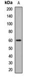 Glucosylceramidase Beta antibody, orb412717, Biorbyt, Western Blot image 