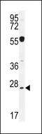 Nipsnap Homolog 3A antibody, LS-C162969, Lifespan Biosciences, Western Blot image 