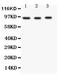 FER Tyrosine Kinase antibody, LS-C313021, Lifespan Biosciences, Western Blot image 