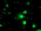 Nicotinamide N-Methyltransferase antibody, LS-B9960, Lifespan Biosciences, Immunofluorescence image 