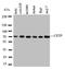 Cholesteryl Ester Transfer Protein antibody, LS-C313143, Lifespan Biosciences, Western Blot image 