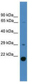 Ubiquitin Domain Containing 2 antibody, TA342602, Origene, Western Blot image 