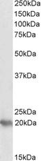 P53 Apoptosis Effector Related To PMP22 antibody, LS-B11149, Lifespan Biosciences, Western Blot image 