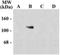 Glutamate Ionotropic Receptor NMDA Type Subunit 1 antibody, NB300-116, Novus Biologicals, Western Blot image 