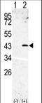 Signal Peptide Peptidase Like 3 antibody, LS-C100062, Lifespan Biosciences, Western Blot image 