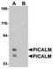 Phosphatidylinositol-binding clathrin assembly protein antibody, TA306899, Origene, Western Blot image 
