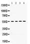 Matrix Metallopeptidase 8 antibody, PB9727, Boster Biological Technology, Western Blot image 