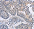 F-Box Protein 32 antibody, A2759, ABclonal Technology, Immunohistochemistry paraffin image 