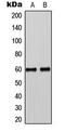 SMAD Family Member 3 antibody, LS-C354028, Lifespan Biosciences, Western Blot image 