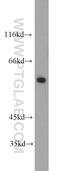 F-Box Protein 5 antibody, 10872-1-AP, Proteintech Group, Western Blot image 