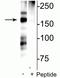GRIN2B antibody, P01883, Boster Biological Technology, Western Blot image 