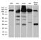 Importin 5 antibody, LS-C796181, Lifespan Biosciences, Western Blot image 