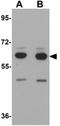 SH3 Domain Containing Ring Finger 2 antibody, GTX85000, GeneTex, Western Blot image 