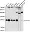 Glutathione S-transferase kappa 1 antibody, GTX65889, GeneTex, Western Blot image 