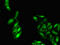 ATPase Phospholipid Transporting 9A (Putative) antibody, orb52382, Biorbyt, Immunocytochemistry image 