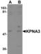 Karyopherin Subunit Alpha 3 antibody, LS-B5341, Lifespan Biosciences, Western Blot image 
