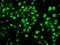 QKI, KH Domain Containing RNA Binding antibody, GTX33450, GeneTex, Immunofluorescence image 
