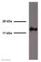 Rac Family Small GTPase 1 antibody, ab33186, Abcam, Western Blot image 