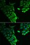 Hyaluronan-binding protein 2 antibody, LS-C334971, Lifespan Biosciences, Immunofluorescence image 