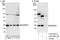 Ubiquitin-conjugating enzyme E2 E2 antibody, A303-484A, Bethyl Labs, Immunoprecipitation image 