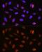 Cleavage Stimulation Factor Subunit 2 Tau Variant antibody, GTX64989, GeneTex, Immunocytochemistry image 