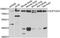 SPT20 Homolog, SAGA Complex Component antibody, A7374, ABclonal Technology, Western Blot image 