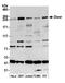 Dicer 1, Ribonuclease III antibody, A301-936A, Bethyl Labs, Western Blot image 