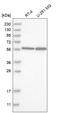 RAD23 Homolog B, Nucleotide Excision Repair Protein antibody, HPA029718, Atlas Antibodies, Western Blot image 