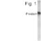 Solute Carrier Family 45 Member 3 antibody, PA1-4230, Invitrogen Antibodies, Western Blot image 