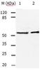 Activin receptor type IIA antibody, orb107473, Biorbyt, Western Blot image 