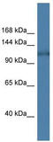 Hexokinase-1 antibody, TA343099, Origene, Western Blot image 