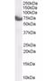 Zinc Finger DHHC-Type Containing 17 antibody, orb18982, Biorbyt, Western Blot image 