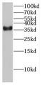 Family With Sequence Similarity 98 Member C antibody, FNab03002, FineTest, Western Blot image 