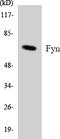 FYN Proto-Oncogene, Src Family Tyrosine Kinase antibody, LS-C291964, Lifespan Biosciences, Western Blot image 