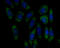F-Box Protein 5 antibody, A05229, Boster Biological Technology, Immunocytochemistry image 