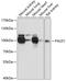 Phosphatase Domain Containing Paladin 1 antibody, GTX66135, GeneTex, Western Blot image 