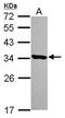 Haloacid Dehalogenase Like Hydrolase Domain Containing 3 antibody, GTX119747, GeneTex, Western Blot image 