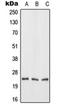 Fibroblast Growth Factor 19 antibody, orb214948, Biorbyt, Western Blot image 