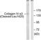 Collagen alpha-3(IV) chain antibody, LS-C121068, Lifespan Biosciences, Western Blot image 